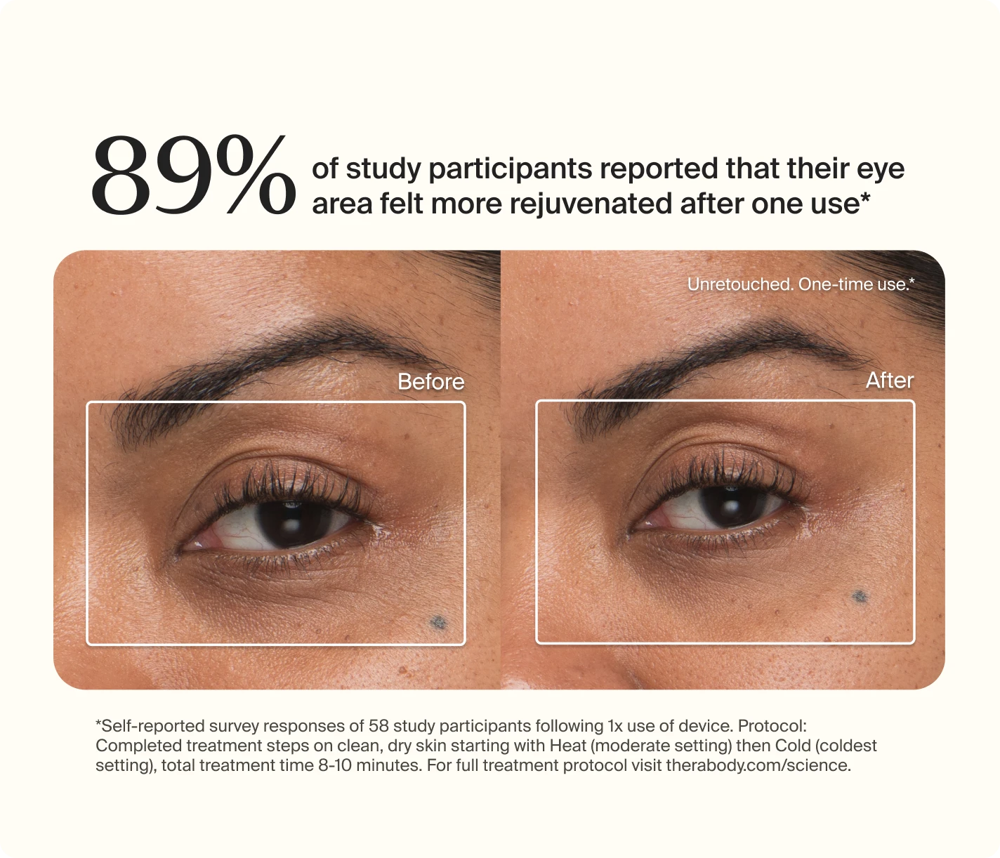 TheraFace Depuffing Wand